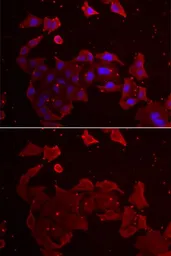 Anti-FLCN antibody used in Immunocytochemistry/ Immunofluorescence (ICC/IF). GTX33200