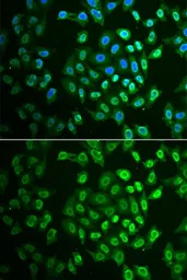 Anti-FAH antibody used in Immunocytochemistry/ Immunofluorescence (ICC/IF). GTX33205
