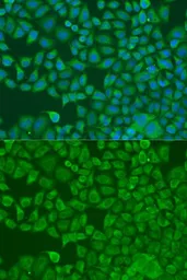Anti-FXR2 antibody used in Immunocytochemistry/ Immunofluorescence (ICC/IF). GTX33207