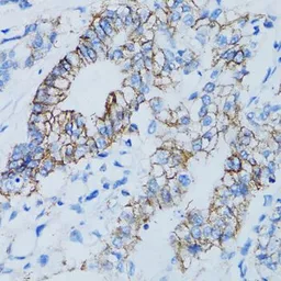 Anti-Galectin 8 antibody used in IHC (Paraffin sections) (IHC-P). GTX33214