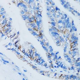Anti-Galectin 8 antibody used in IHC (Paraffin sections) (IHC-P). GTX33214