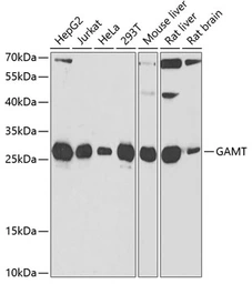 Anti-GAMT antibody used in Western Blot (WB). GTX33215