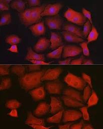 Anti-GAMT antibody used in Immunocytochemistry/ Immunofluorescence (ICC/IF). GTX33215