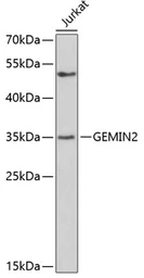 Anti-Gemin2 antibody used in Western Blot (WB). GTX33217