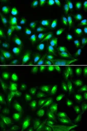 Anti-Gemin2 antibody used in Immunocytochemistry/ Immunofluorescence (ICC/IF). GTX33217