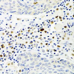 Anti-Gemin2 antibody used in IHC (Paraffin sections) (IHC-P). GTX33217