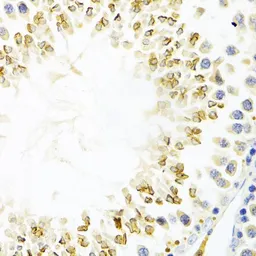 Anti-Gemin2 antibody used in IHC (Paraffin sections) (IHC-P). GTX33217