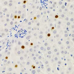 Anti-Gemin2 antibody used in IHC (Paraffin sections) (IHC-P). GTX33217