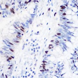 Anti-Geminin antibody used in IHC (Paraffin sections) (IHC-P). GTX33218