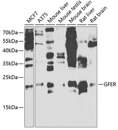 Anti-GFER antibody used in Western Blot (WB). GTX33219