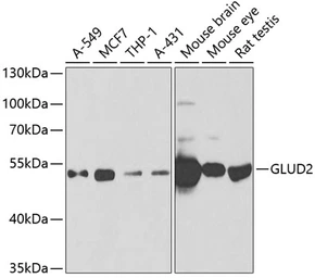 Anti-GLUD2 antibody used in Western Blot (WB). GTX33220