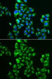 Anti-GLUD2 antibody used in Immunocytochemistry/ Immunofluorescence (ICC/IF). GTX33220