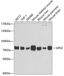 Anti-GPD2 antibody used in Western Blot (WB). GTX33225