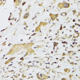 Anti-GPD2 antibody used in IHC (Paraffin sections) (IHC-P). GTX33225