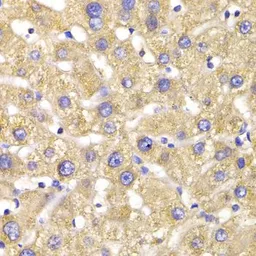 Anti-GPD2 antibody used in IHC (Paraffin sections) (IHC-P). GTX33225