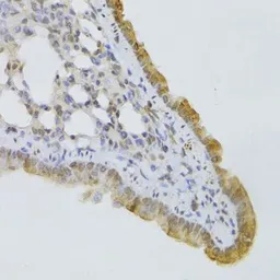 Anti-GPD2 antibody used in IHC (Paraffin sections) (IHC-P). GTX33225