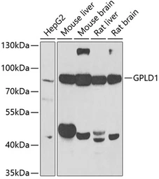Anti-GPLD1 antibody used in Western Blot (WB). GTX33227