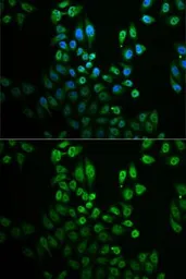 Anti-GPLD1 antibody used in Immunocytochemistry/ Immunofluorescence (ICC/IF). GTX33227