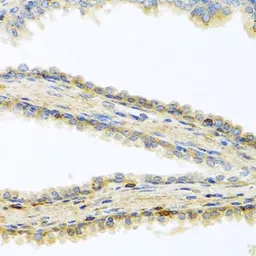 Anti-GPLD1 antibody used in IHC (Paraffin sections) (IHC-P). GTX33227