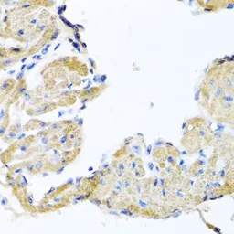 Anti-GPLD1 antibody used in IHC (Paraffin sections) (IHC-P). GTX33227