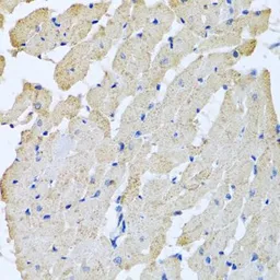 Anti-GPLD1 antibody used in IHC (Paraffin sections) (IHC-P). GTX33227