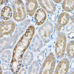Anti-GRPEL2 antibody used in IHC (Paraffin sections) (IHC-P). GTX33230