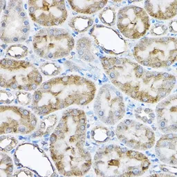 Anti-GRPEL2 antibody used in IHC (Paraffin sections) (IHC-P). GTX33230