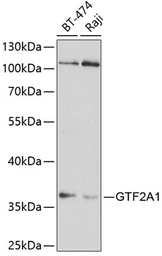 Anti-GTF2A1 antibody used in Western Blot (WB). GTX33231