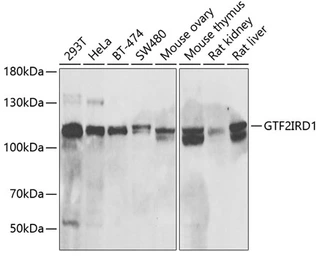Anti-GTF2IRD1 antibody used in Western Blot (WB). GTX33232