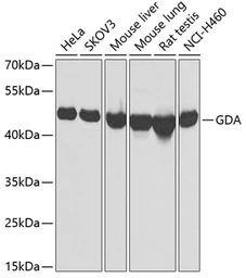 Anti-Guanine deaminase antibody used in Western Blot (WB). GTX33233
