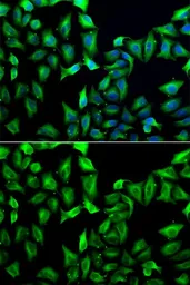 Anti-Guanine deaminase antibody used in Immunocytochemistry/ Immunofluorescence (ICC/IF). GTX33233