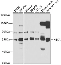Anti-HEXA antibody used in Western Blot (WB). GTX33239