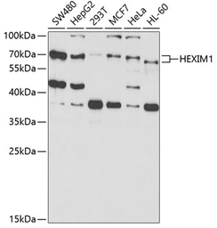Anti-HEXIM1 antibody used in Western Blot (WB). GTX33240