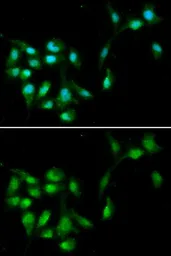 Anti-HEXIM1 antibody used in Immunocytochemistry/ Immunofluorescence (ICC/IF). GTX33240