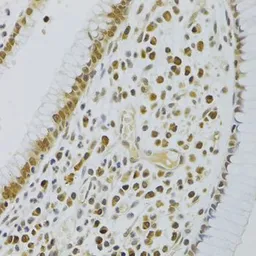 Anti-HEXIM1 antibody used in IHC (Paraffin sections) (IHC-P). GTX33240