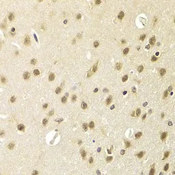 Anti-HEXIM1 antibody used in IHC (Paraffin sections) (IHC-P). GTX33240
