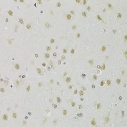 Anti-HEXIM1 antibody used in IHC (Paraffin sections) (IHC-P). GTX33240