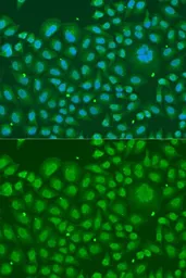 Anti-hnRNP R antibody used in Immunocytochemistry/ Immunofluorescence (ICC/IF). GTX33244