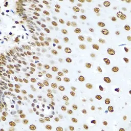 Anti-hnRNP R antibody used in IHC (Paraffin sections) (IHC-P). GTX33244