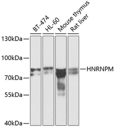 Anti-hnRNP M antibody used in Western Blot (WB). GTX33245