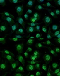 Anti-hnRNP M antibody used in Immunocytochemistry/ Immunofluorescence (ICC/IF). GTX33245
