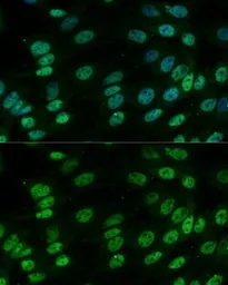 Anti-hnRNP M antibody used in Immunocytochemistry/ Immunofluorescence (ICC/IF). GTX33245