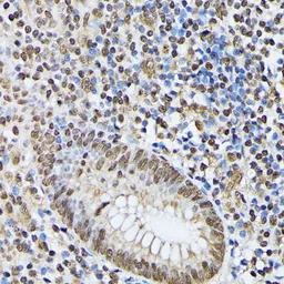 Anti-hnRNP M antibody used in IHC (Paraffin sections) (IHC-P). GTX33245