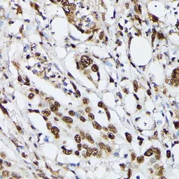 Anti-hnRNP M antibody used in IHC (Paraffin sections) (IHC-P). GTX33245