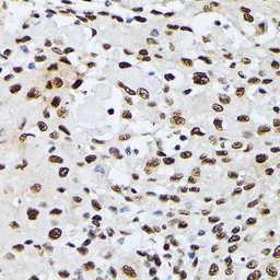 Anti-hnRNP M antibody used in IHC (Paraffin sections) (IHC-P). GTX33245