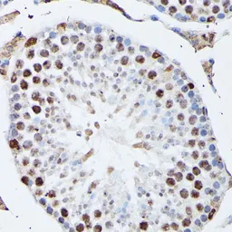 Anti-hnRNP M antibody used in IHC (Paraffin sections) (IHC-P). GTX33245