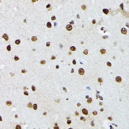 Anti-hnRNP M antibody used in IHC (Paraffin sections) (IHC-P). GTX33245