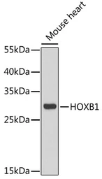 Anti-HOXB1 antibody used in Western Blot (WB). GTX33246