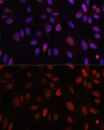 Anti-HOXB1 antibody used in Immunocytochemistry/ Immunofluorescence (ICC/IF). GTX33246
