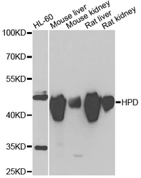 Anti-HPD antibody used in Western Blot (WB). GTX33247